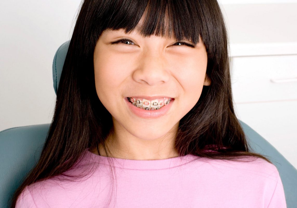 Girl with braces smiling