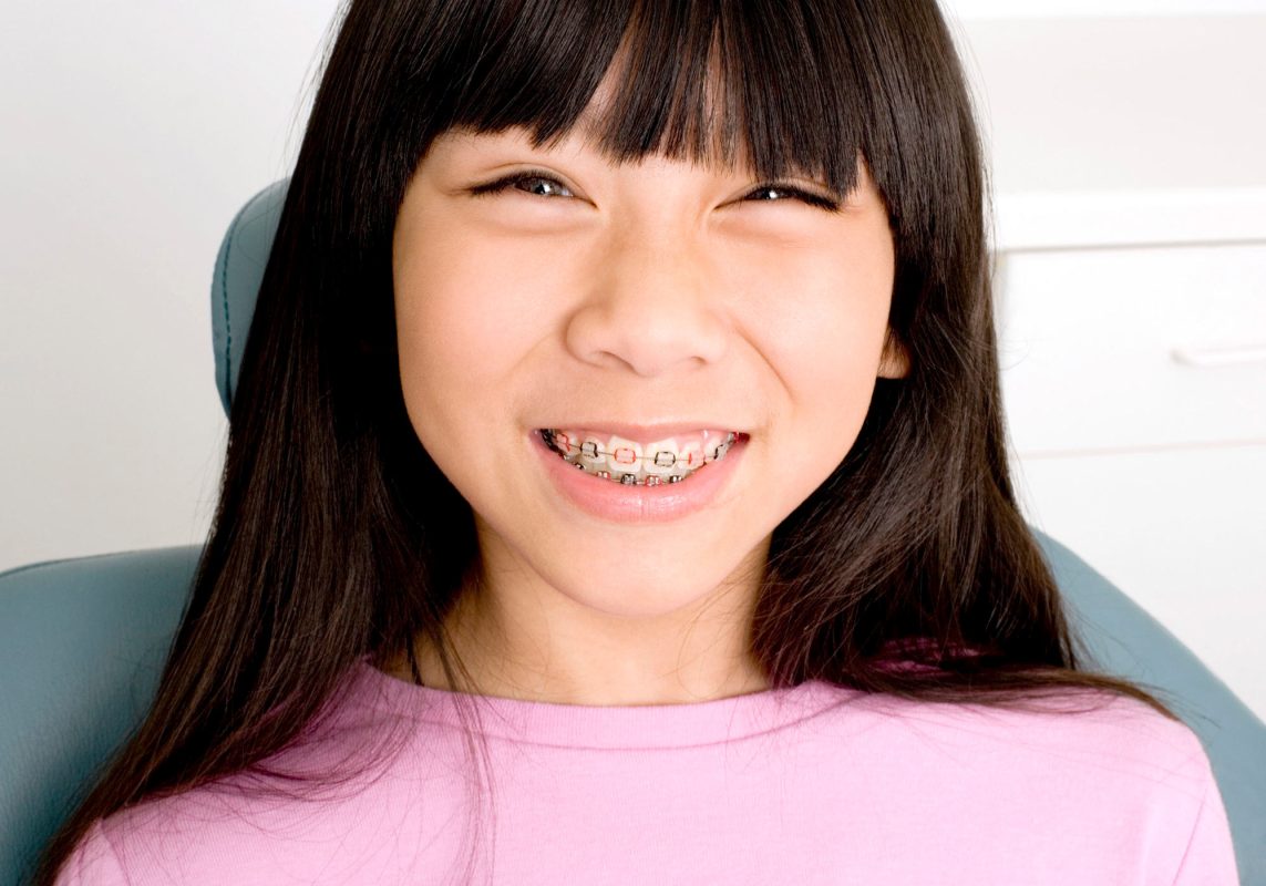 Flossing with braces can be tricky but... 